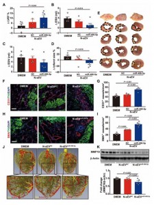 Science子刊：含有miR-486-5p的小细胞外囊泡促进小鼠和非人类灵长类动物心肌梗死后的血管生成