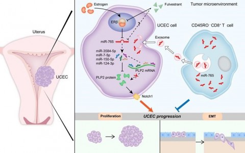 复旦大学附属妇产科医院：CD45RO- CD8+ T细胞衍生的外泌体调节ERβ信号通路抑制子宫内膜癌的发展