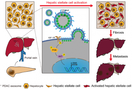 【Gut】上交张艺凡/李青峰、复旦傅德良揭示：外泌体CD44v6/C1QBP促进胰腺癌肝转移的新机制