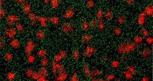 【JCI】细胞外囊泡介导miRNA的应激颗粒调控亨廷顿症的病理生理结果