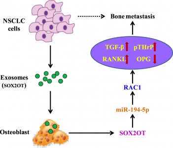 复旦大学肿瘤医院：外泌体lncRNA-SOX2OT靶向破骨细胞促进非小细胞肺癌骨转移