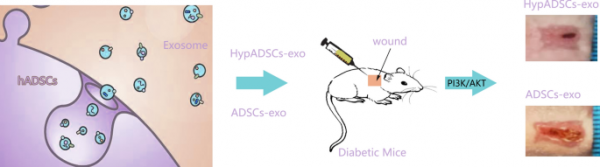 哈医大二院：乏氧脂肪干细胞衍生的外泌体促进糖尿病相关的伤口愈合