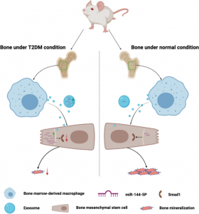 武汉大学中南医院：外泌体miR-144-5p调节骨髓微环境抑制糖尿病相关骨修复