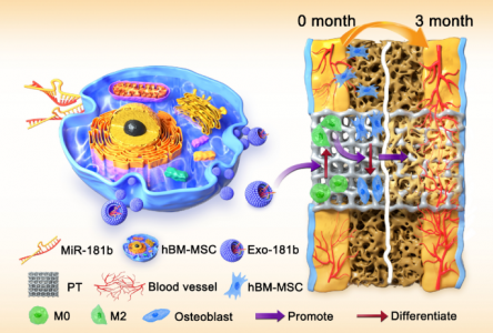 海军军医大学：工程化的外泌体miR-181b通过调节巨噬细胞极化改善骨整合