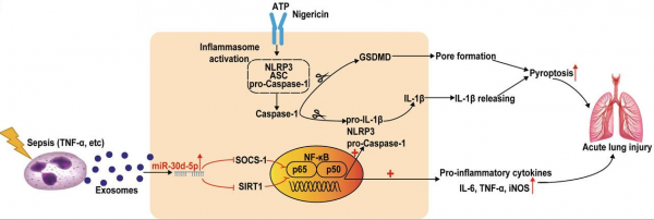 南京大学医学院：中性粒细胞的外泌体在脓毒症相关的急性肺损伤中诱导M1巨噬细胞极化并引发细胞焦亡