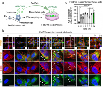 Redox Biology：巨噬细胞铁死亡依赖性细胞外囊泡促进石棉诱导的恶性间皮瘤发生