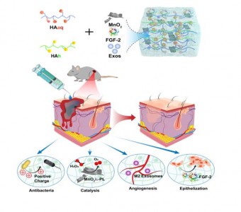 Small：多功能水凝胶通过缓释外泌体和FGF-2加速糖尿病创面愈合
