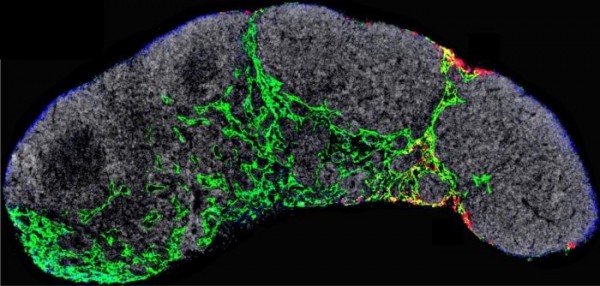 Nature Cancer：黑色素瘤来源的细胞外囊泡通过NGFR依赖性机制诱导肿瘤淋巴结转移