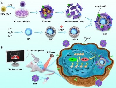 J Nanobiotechnol：时空分辨的人工外泌体用于去乙酰化酶抑制剂的靶向递送