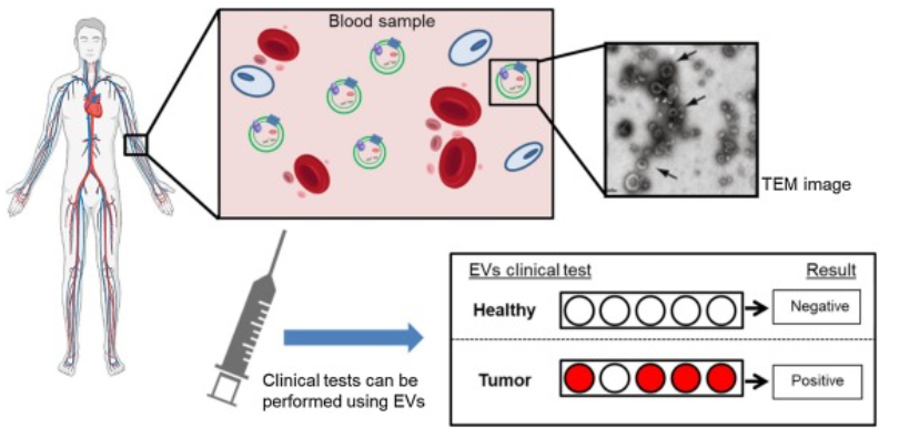 【综述】Semin Cancer Biol丨细胞外囊泡在癌症研究中的利弊——论循证医学的重要性