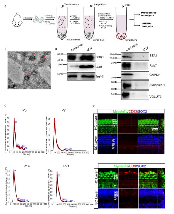 Cell Mol Life Sci | 东南大学柴人杰团队：在耳蜗组织细胞外囊泡领域获得新进展