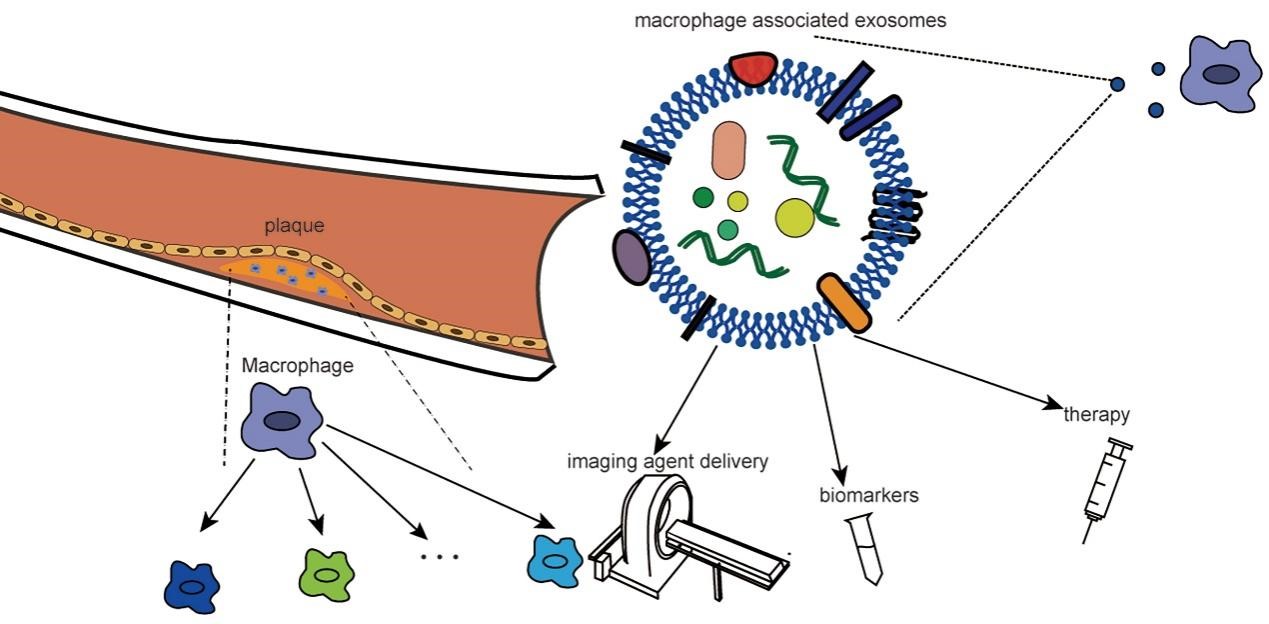 Int J Biol Sci |青岛大学附属医院潘旭东、朱晓岩团队：动脉粥样硬化中外泌体：聚焦巨噬细胞