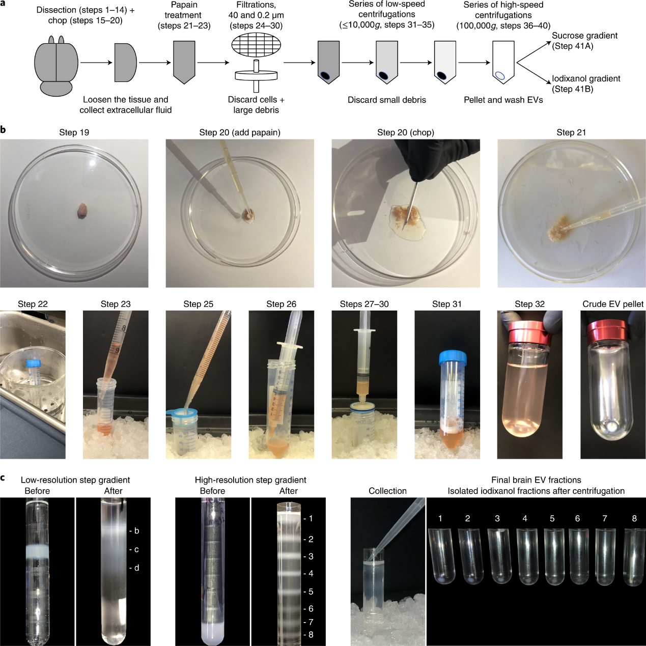 Nature Protocols丨如何从脑组织中分离线粒体囊泡、微囊泡和外泌体亚群