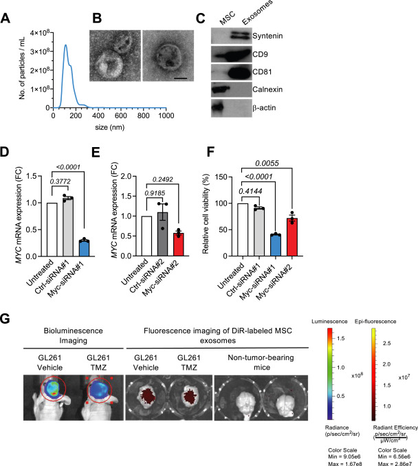 Extracellular Vesicle丨Kalluri团队开发了新的靶向MYC的工程外泌体用于胶质瘤治疗