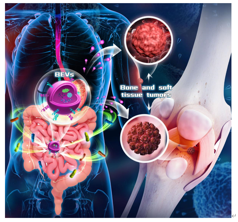 Theranostics | 上海大学转化医学研究院苏佳灿教授团队发表重要综述：基于细菌外囊泡的骨和软组织肿瘤治疗策略