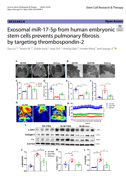 Stem Cell Res Ther |中国科学院生物物理研究所姬广聚课题组揭示人源胚胎干细胞外泌体在肺纤维化治疗中的作用和机制