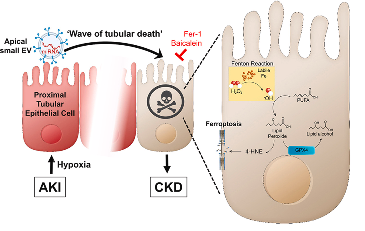 Redox Biol丨近端肾小管上皮细胞来源的小细胞外囊泡介导铁死亡传播