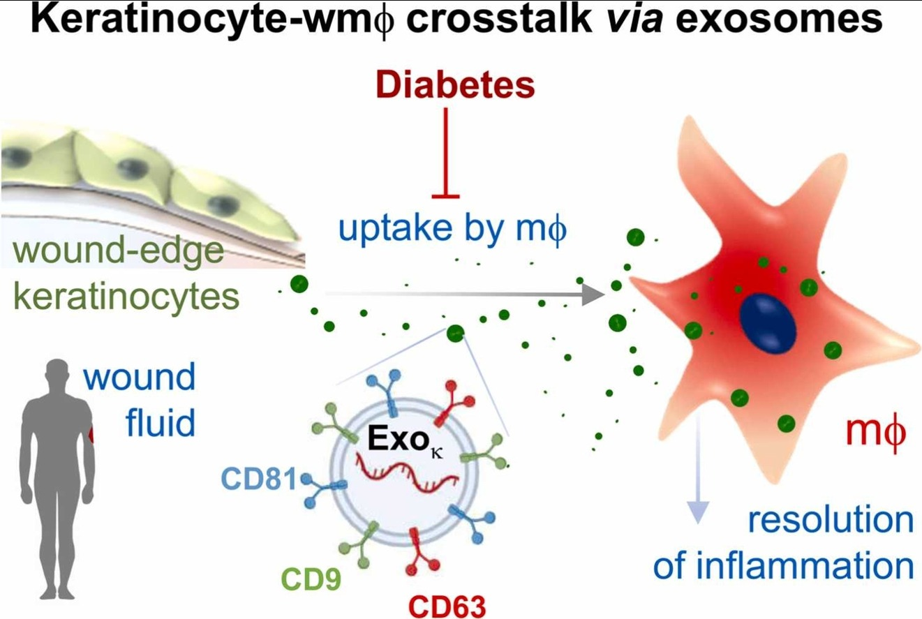 Nano Today丨伤口液中角质细胞源外泌体的特征及其在糖尿病患者中的功能